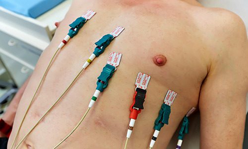 Understanding Electrocardiograms: Insights into Heart Health